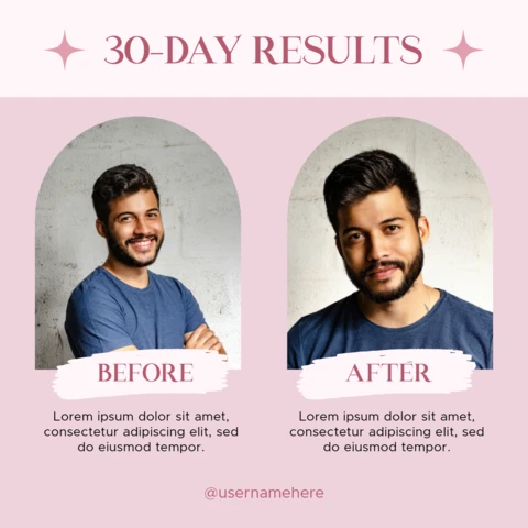 Before and After 30 Day Results Instagram Post Design Template